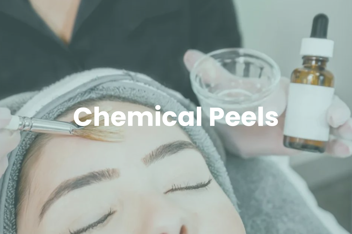 Chemical Peels