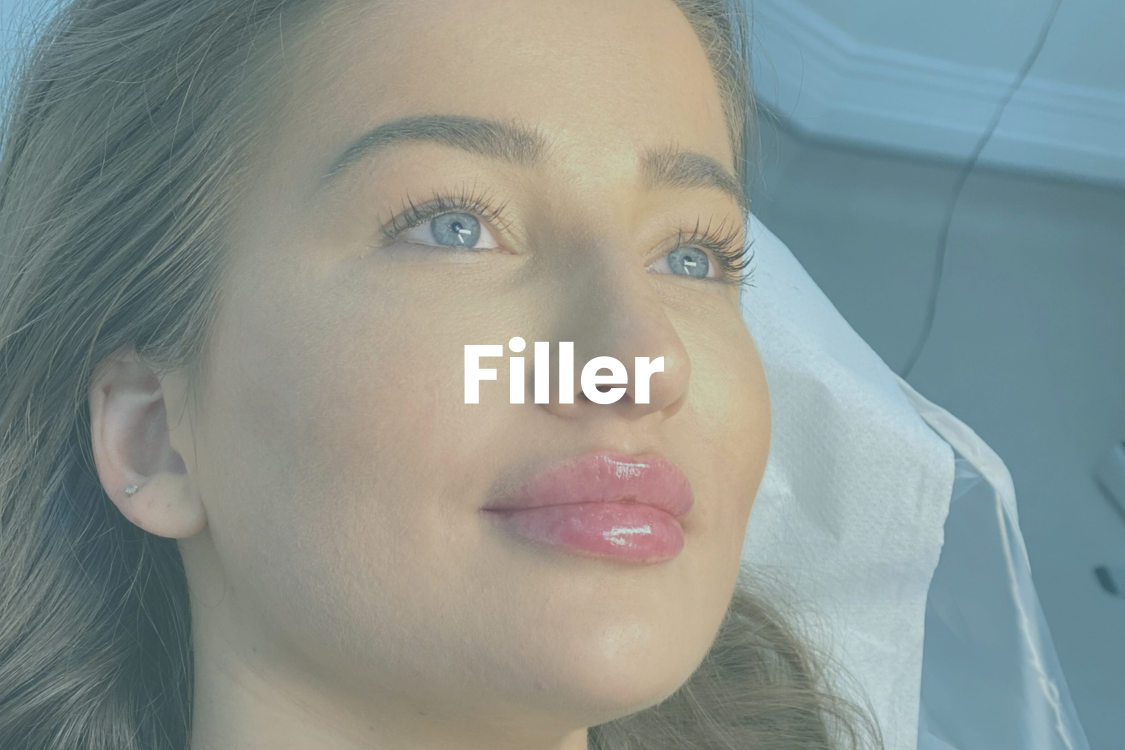 Filler