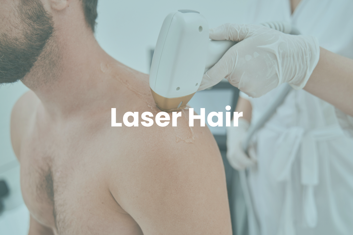 Laser Hair Removal
